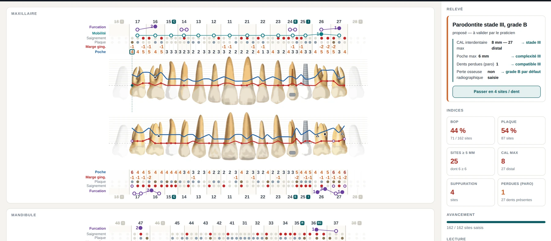 Full chart — demonstration case